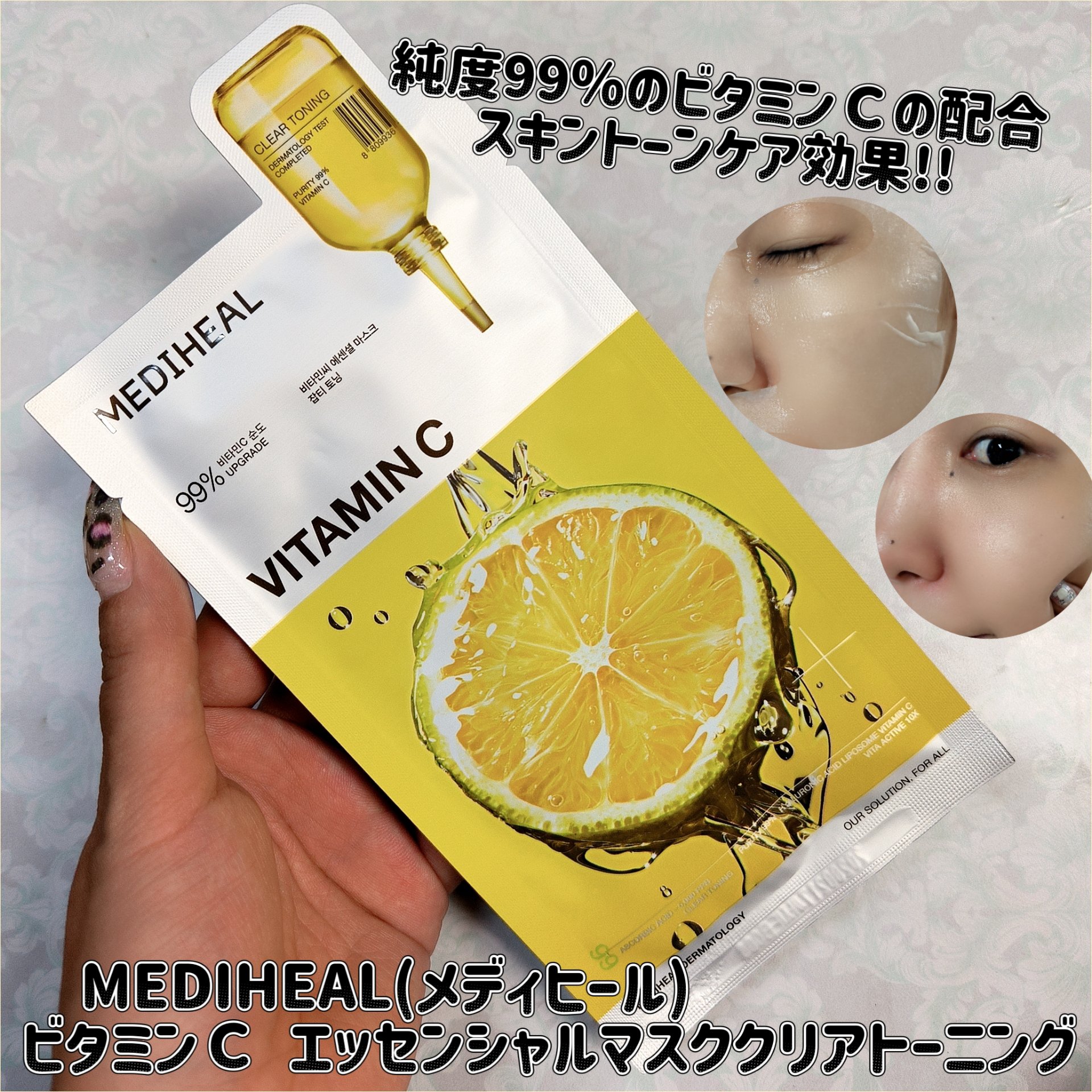 MEDIHEAL(メディヒール) ビタミンＣ エッセンシャルマスククリアトーニング

純度99％のビタミンＣの配合で、優れたスキントーンケア効果!!

肌に優しいビタミン成分だから、敏感で荒れた肌でも◎。 低刺激のヴィーガン認証済みシート。