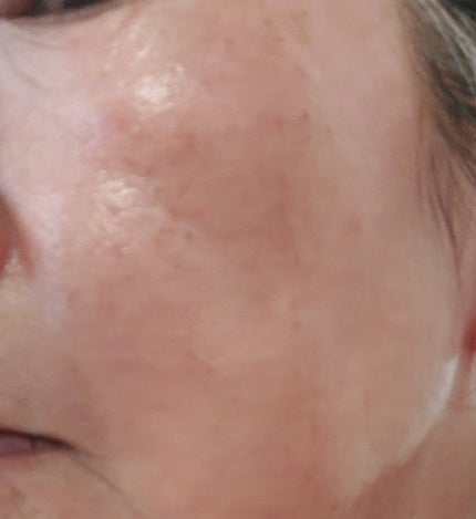 ミシャ ビタシープラス 薬用ブライトニング美容液/MISSHA/美容液を使ったクチコミ(6枚目)