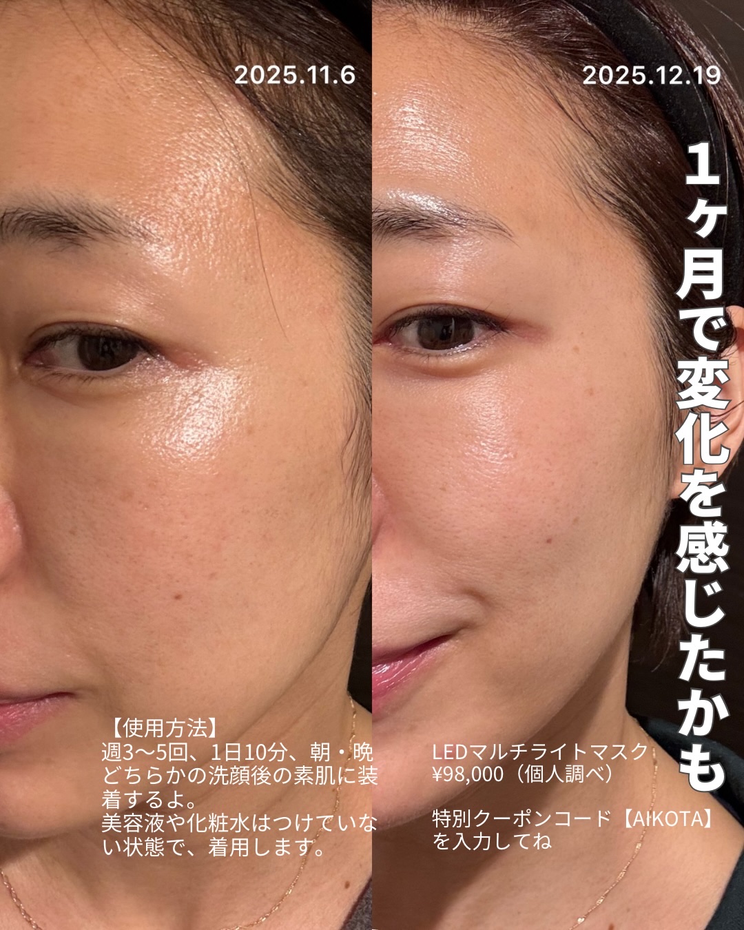 LEDマルチライトマスク/CurrentBody/美顔器・マッサージを使ったクチコミ（2枚目）