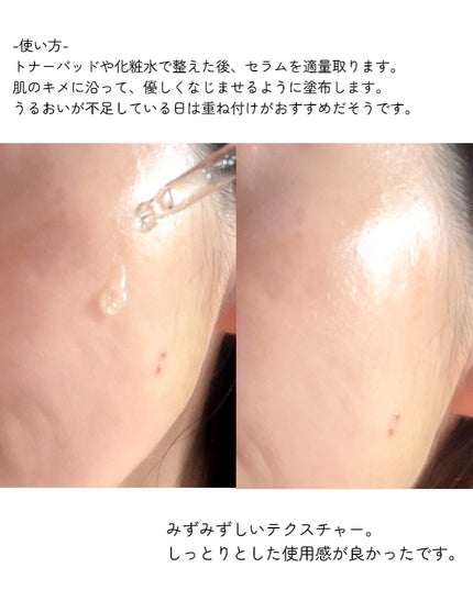 トラブルターゲティングセラム/EIOM/美容液を使ったクチコミ(8枚目)