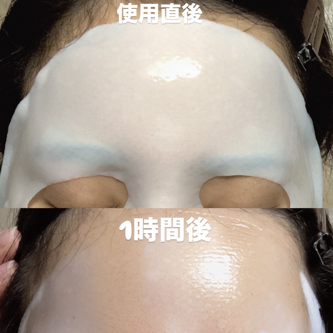 パーフェクト リアル パフォーマンス コラーゲンマスクパック /ダーマフィックス/シートマスク・パックを使ったクチコミ（3枚目）