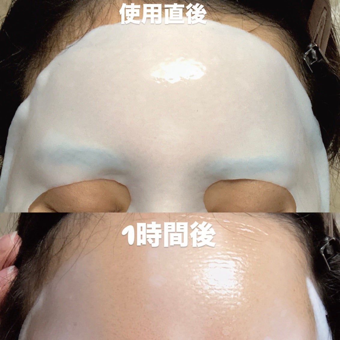 パーフェクト リアル パフォーマンス コラーゲンマスクパック /ダーマフィックス/シートマスク・パックを使ったクチコミ(3枚目)