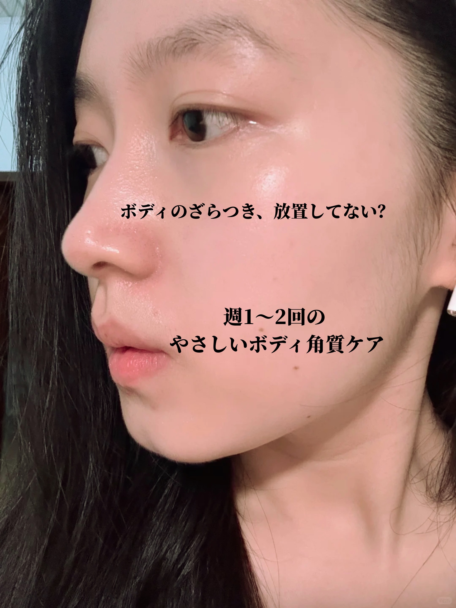 AHA 30% + BHA 2% Peeling Solution/The Ordinary/ピーリングを使ったクチコミ（1枚目）
