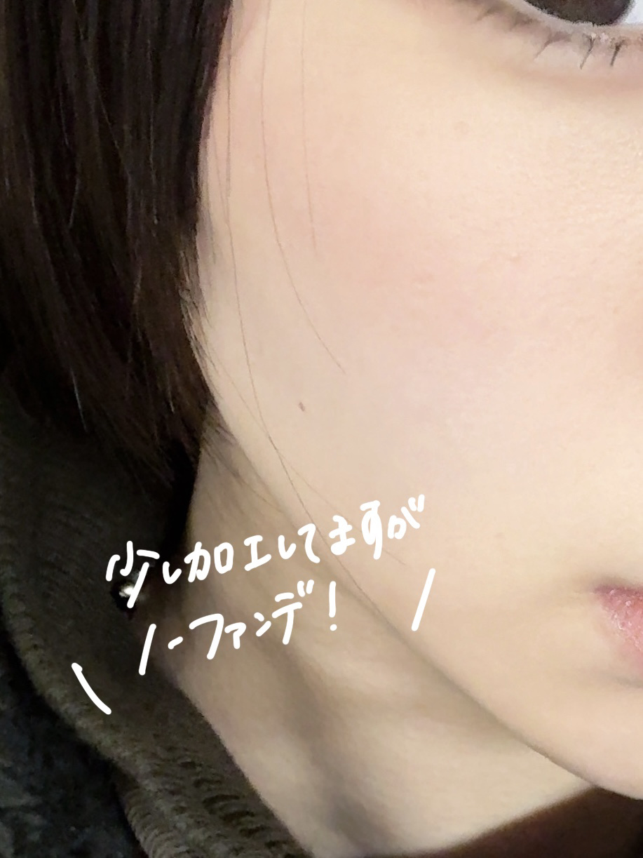 薬用ホワイトニングローションα EX/TOUT VERT/化粧水を使ったクチコミ（3枚目）