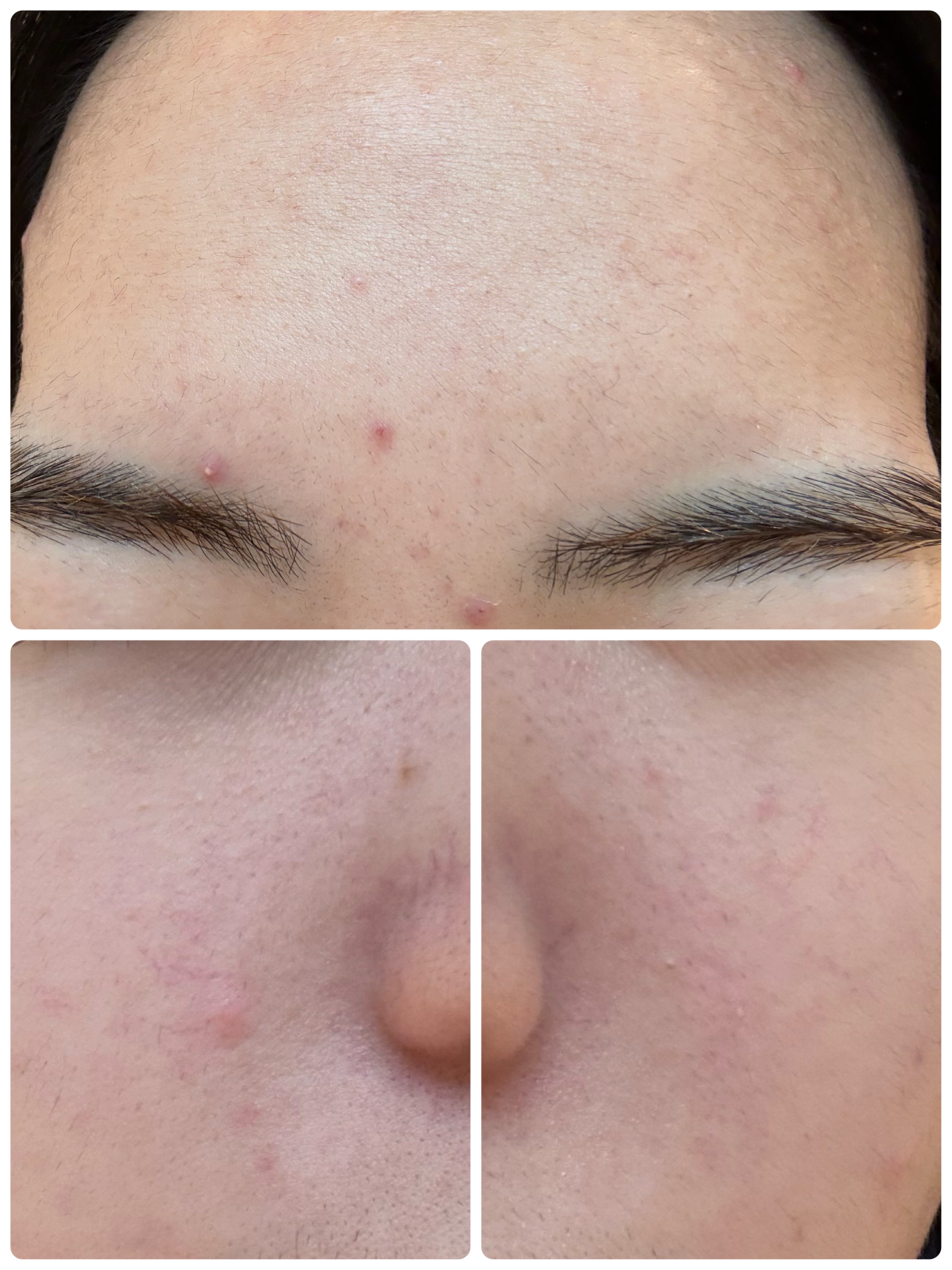 ディズム EMS EER メディスキンケアデバイス/DISM/美顔器・マッサージを使ったクチコミ（3枚目）