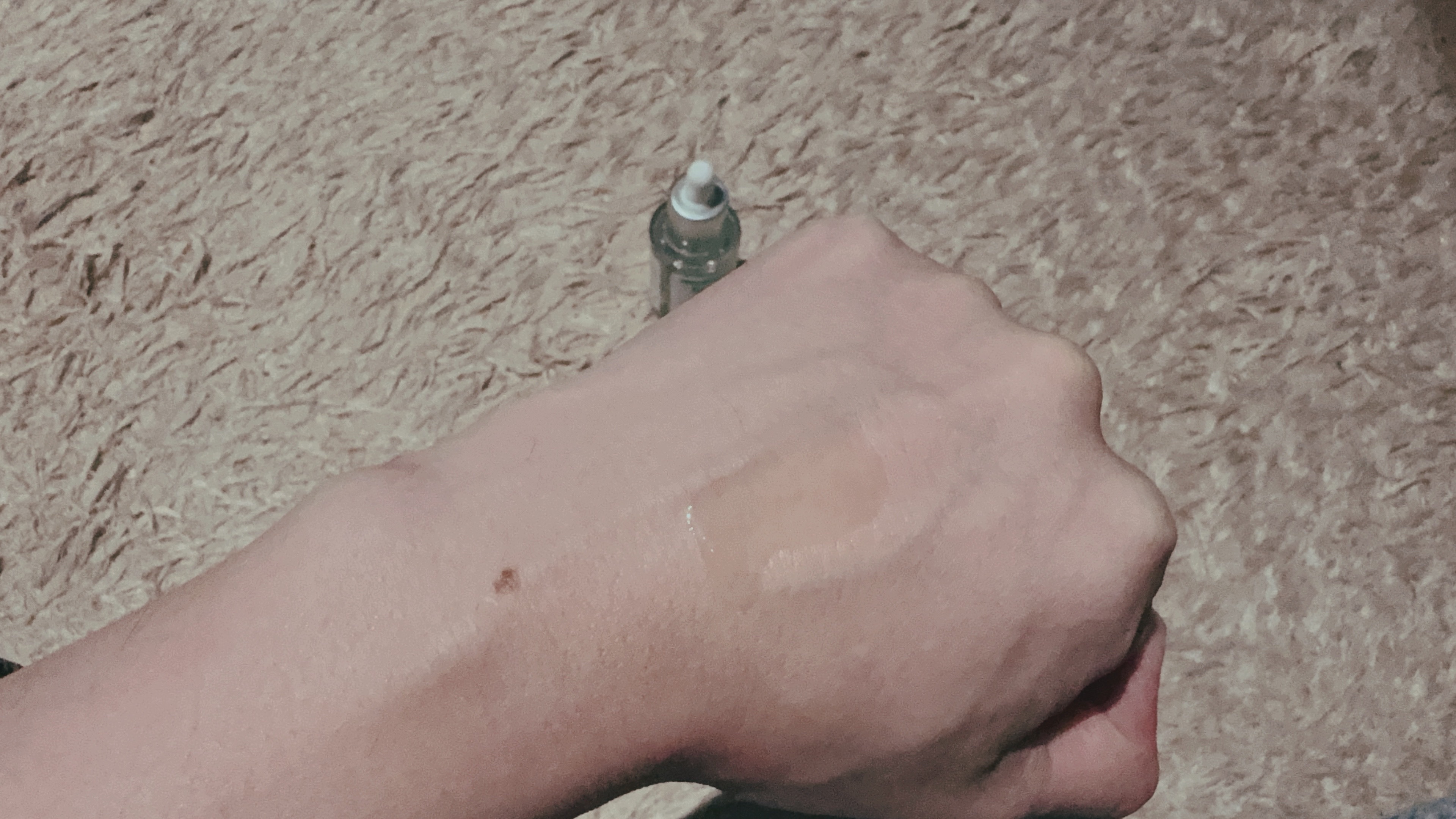 アゼライン酸17セラム/Dr.Melaxin/美容液を使ったクチコミ（2枚目）