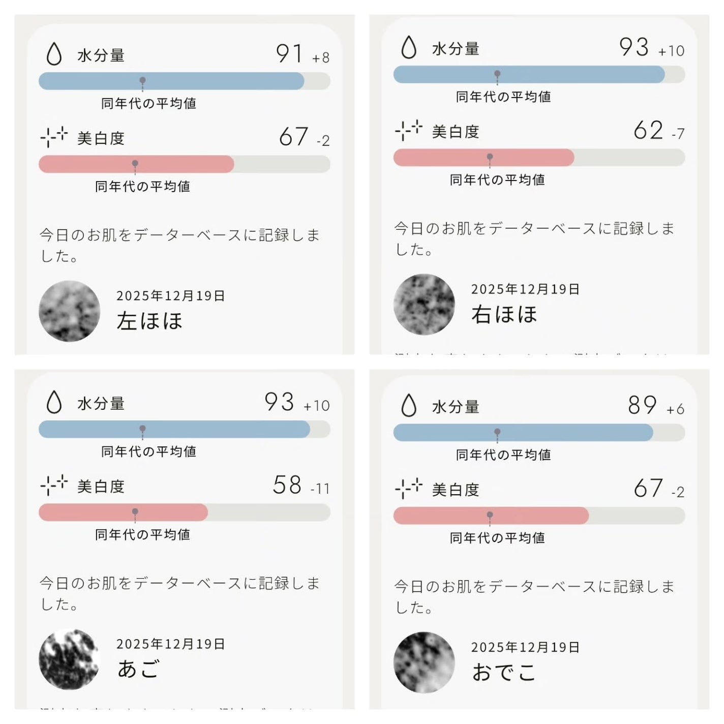 スキンスキャナー/BELLATECH/その他スキンケアグッズを使ったクチコミ(4枚目)