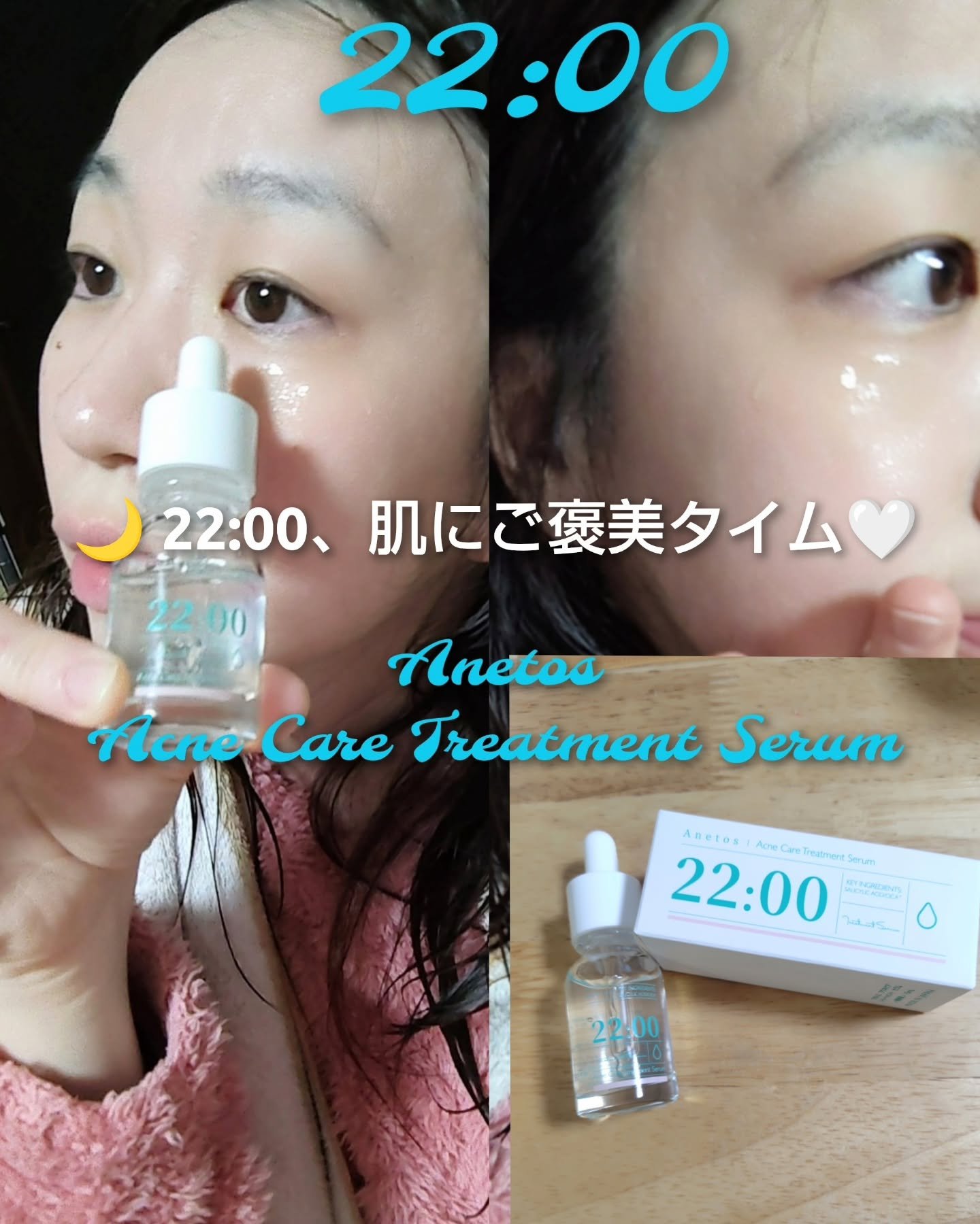 アネトス アクネケア トリートメント セラム/Anetos/美容液を使ったクチコミ（1枚目）