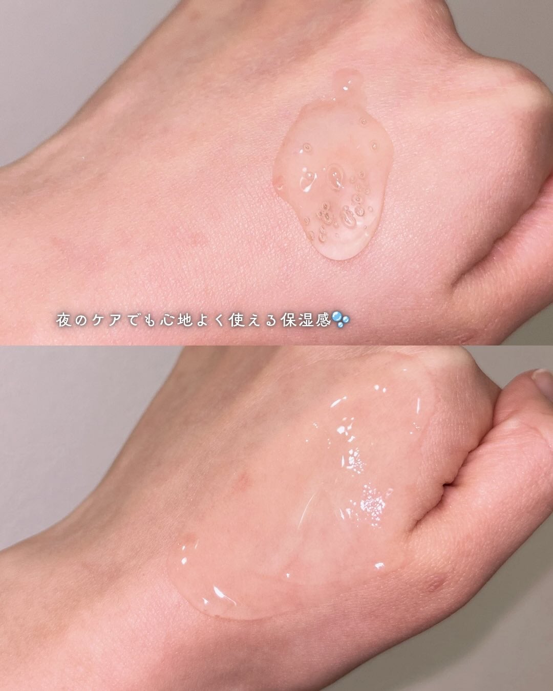 アネトス アクネケア トリートメント セラム/Anetos/美容液を使ったクチコミ(4枚目)