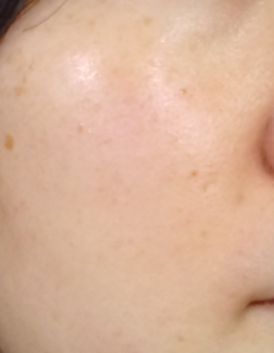 白潤薬用美白化粧水/肌ラボ/化粧水を使ったクチコミ（1枚目）