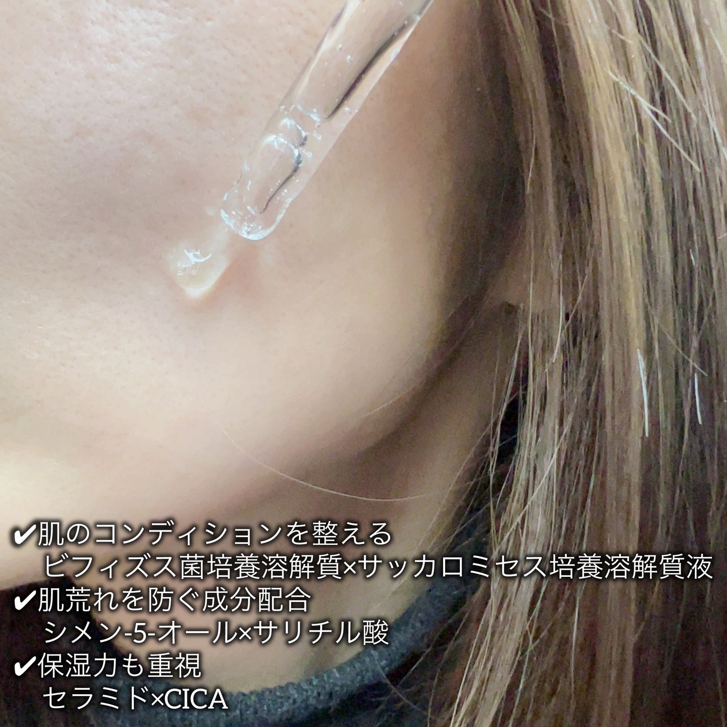 アネトス アクネケア トリートメント セラム/Anetos/美容液を使ったクチコミ(4枚目)