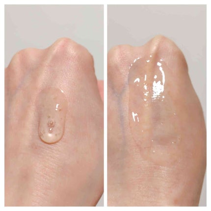 アネトス アクネケア トリートメント セラム/Anetos/美容液を使ったクチコミ(5枚目)