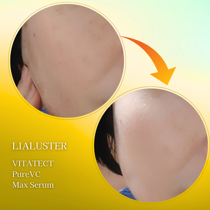 VITATECT PureVC Max Serum/LIALUSTER/美容液を使ったクチコミ(7枚目)
