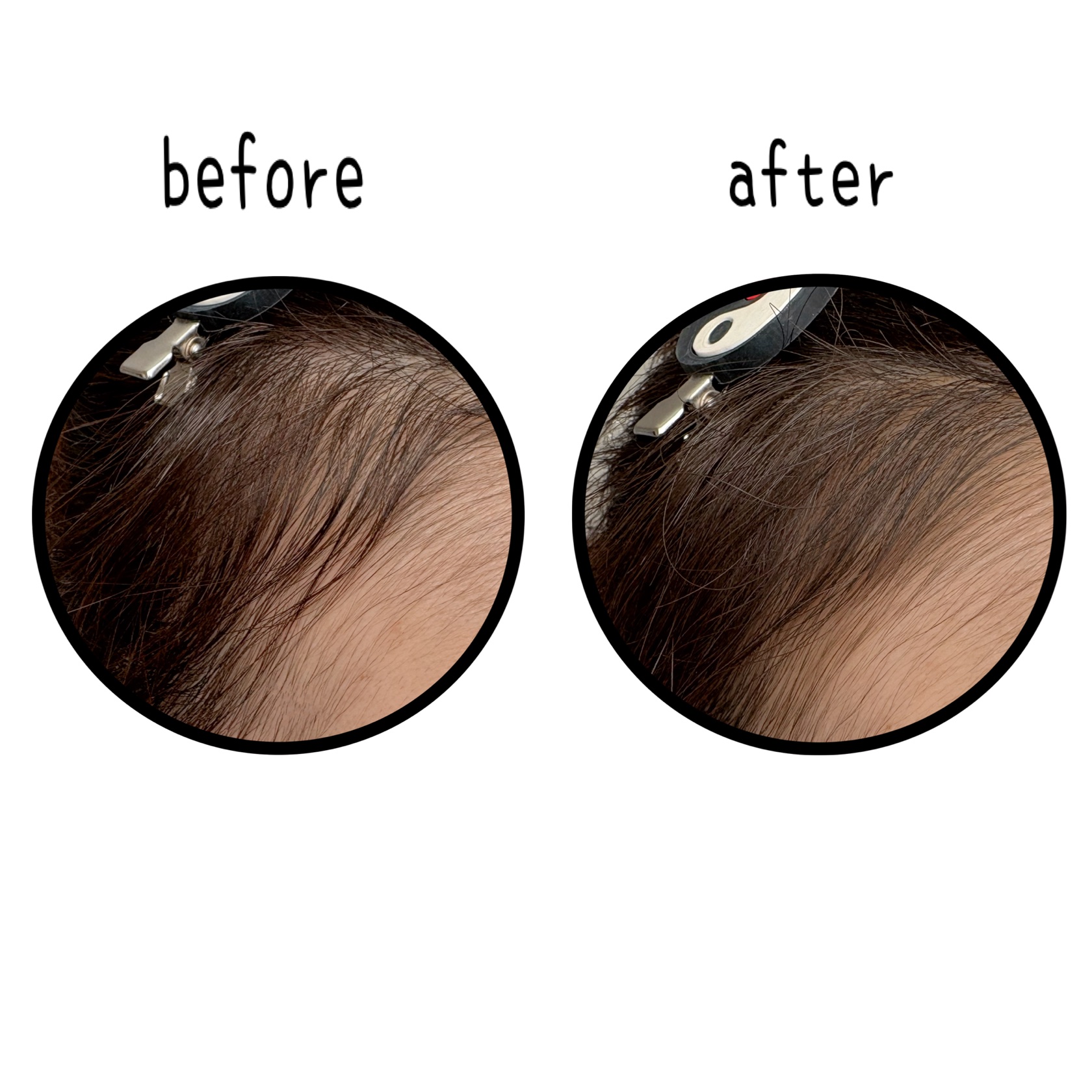  ヘアコンシーラーパレット&アーティスト デュアルブラシ/odiD/その他スタイリングを使ったクチコミ（3枚目）