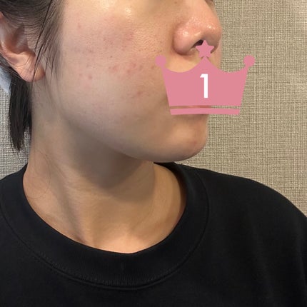 を使ったクチコミ(3枚目)