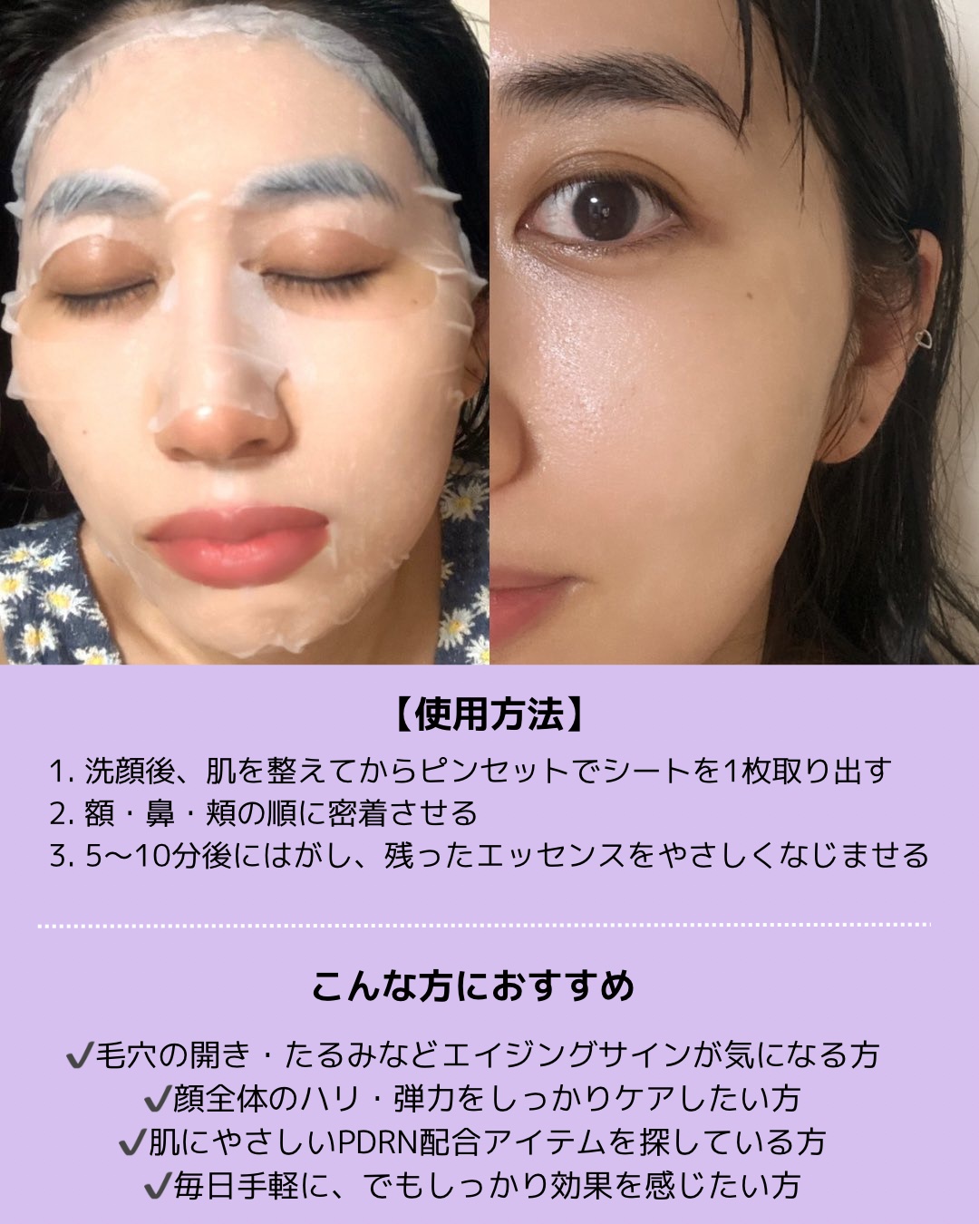 PDRN リフティングマスク/MEDIHEAL/シートマスク・パックを使ったクチコミ（3枚目）