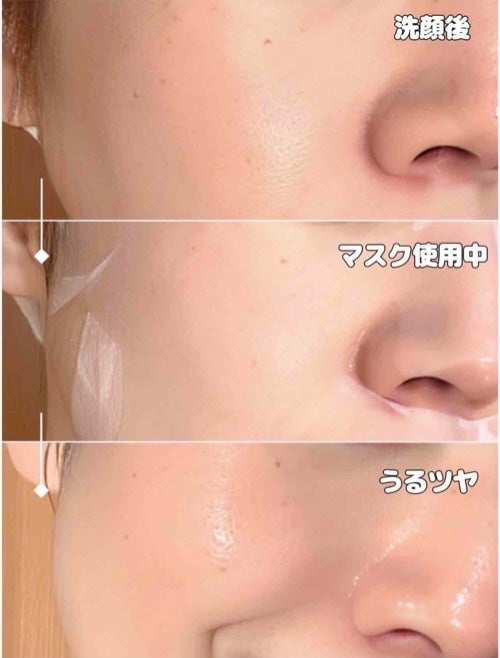 PDRN リフティングマスク/MEDIHEAL/シートマスク・パックを使ったクチコミ(4枚目)