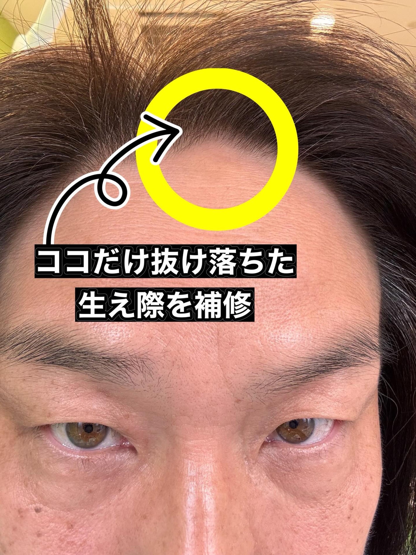 ヘアコンシーラーパレット&アーティスト デュアルブラシ/odiD/その他スタイリングを使ったクチコミ(4枚目)