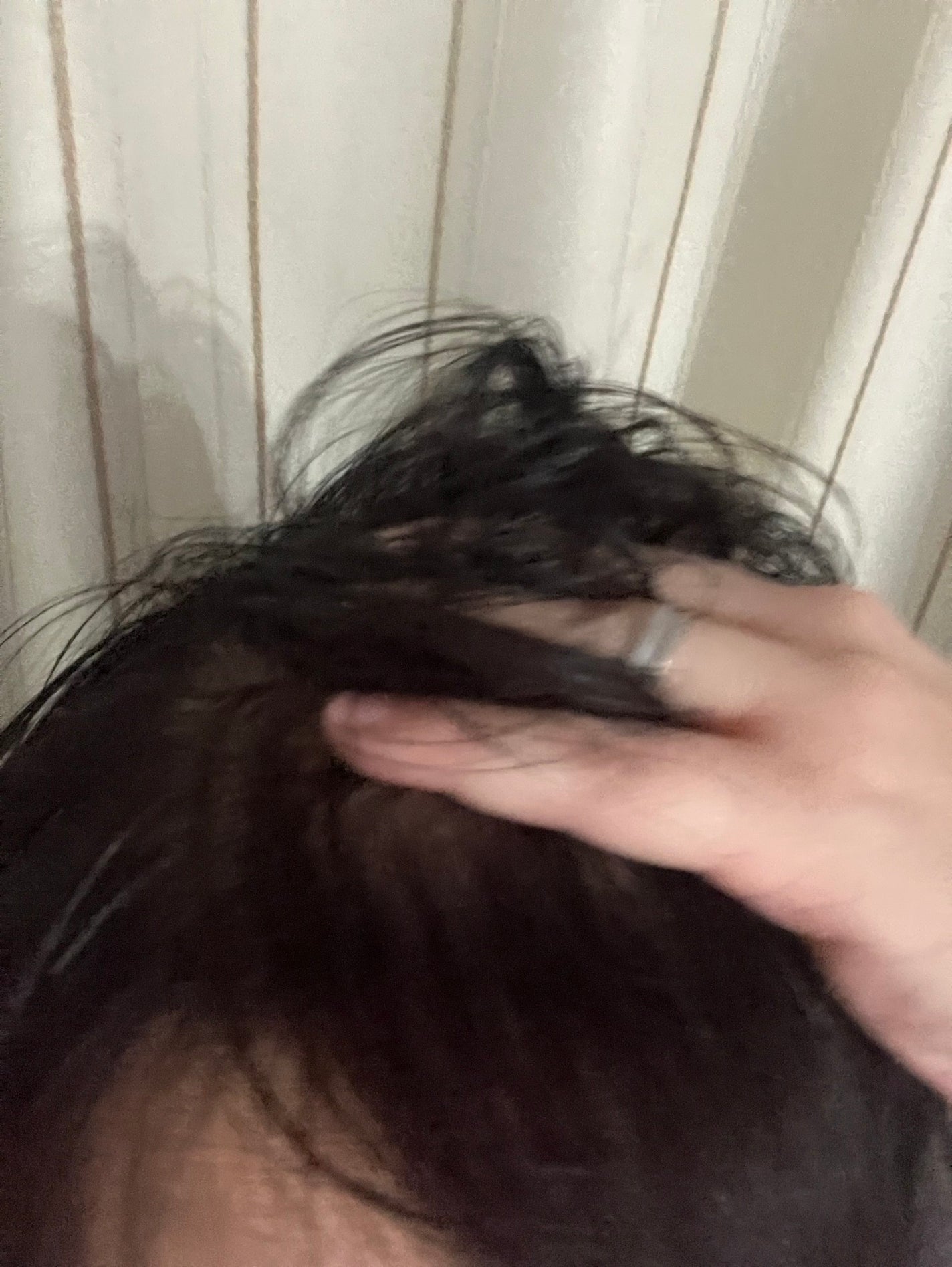 セグレタ髪を育むスプレー/セグレタ/頭皮ローションを使ったクチコミ(5枚目)