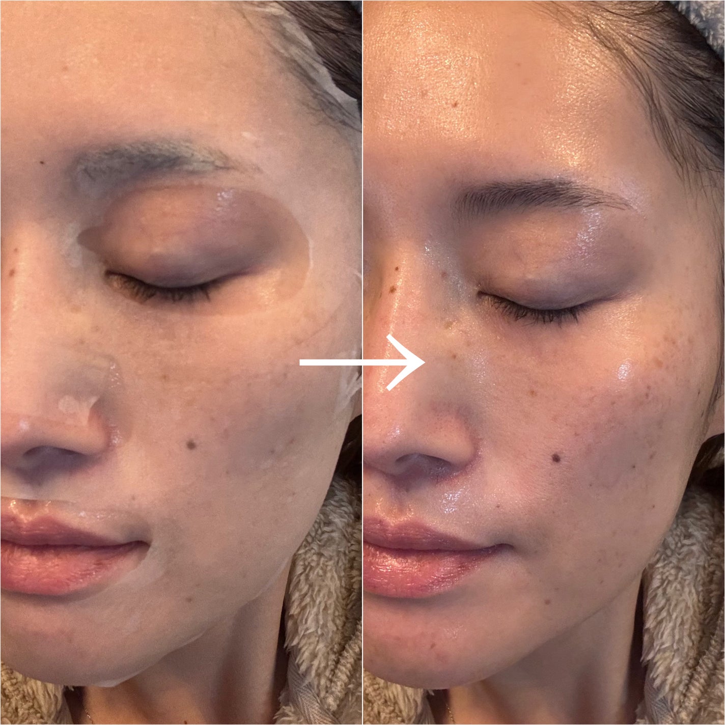 PDRN リフティングマスク/MEDIHEAL/シートマスク・パックを使ったクチコミ(4枚目)