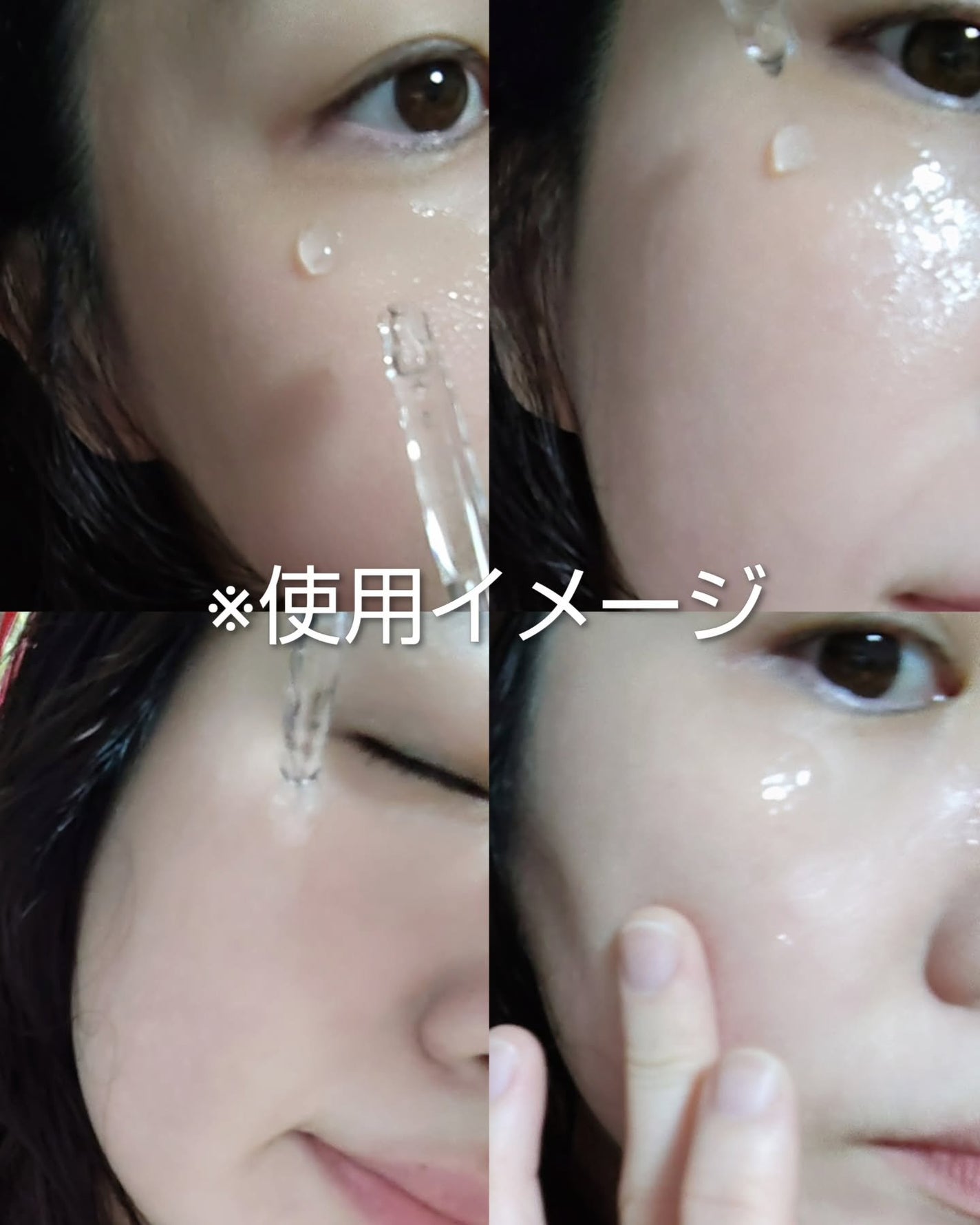 アネトス アクネケア トリートメント セラム/Anetos/美容液を使ったクチコミ(6枚目)