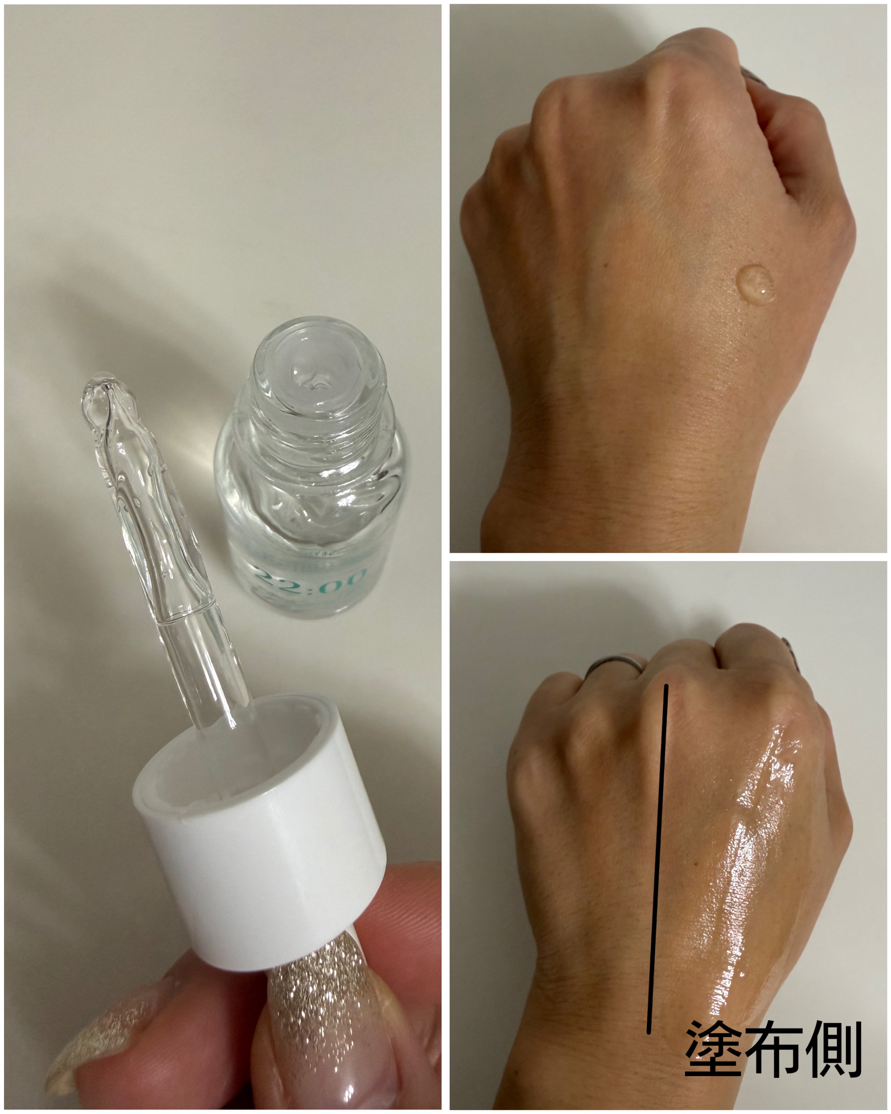 アネトス アクネケア トリートメント セラム/Anetos/美容液を使ったクチコミ（3枚目）