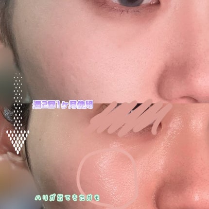 ペンタショット/CELORABY/美顔器・マッサージを使ったクチコミ(3枚目)