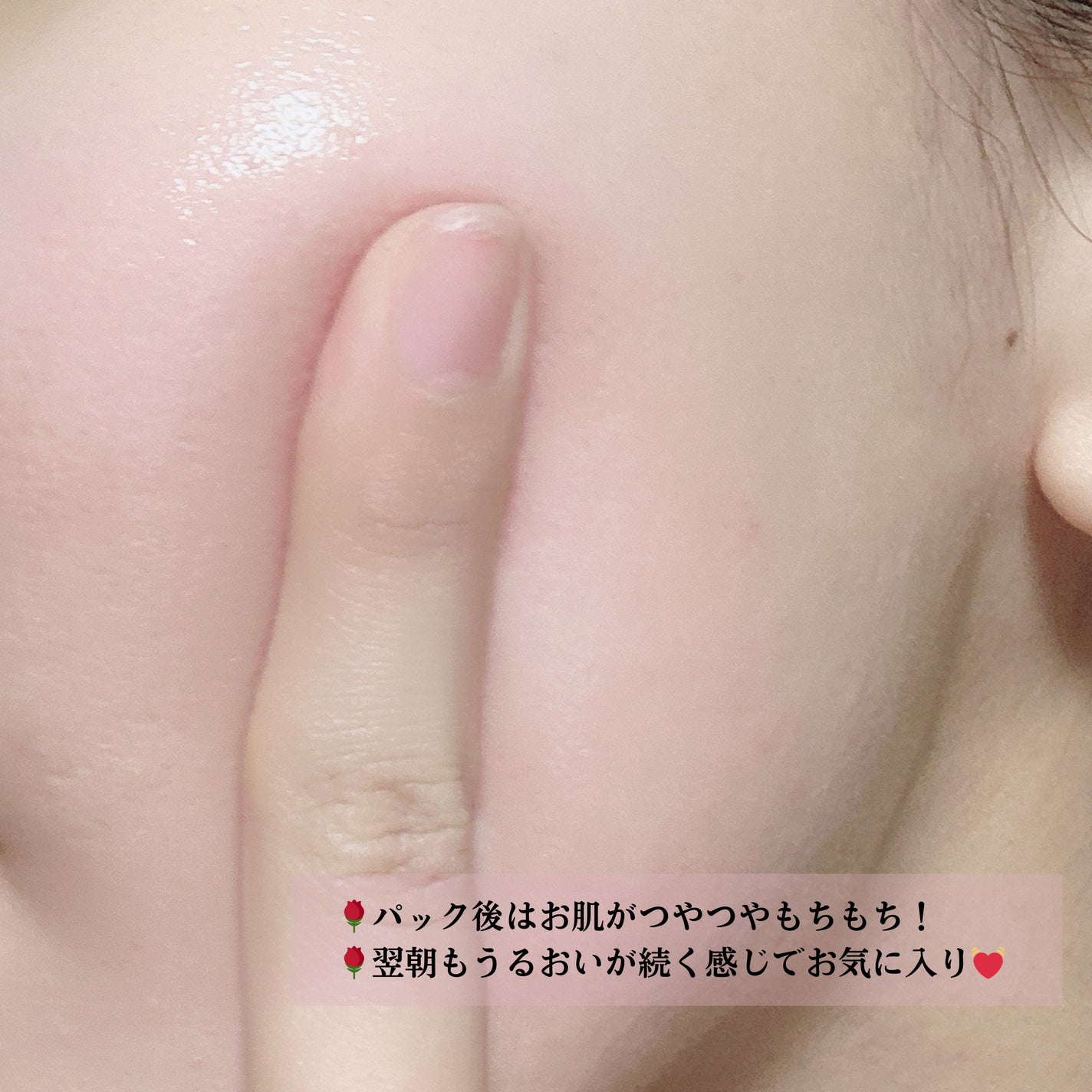 ローゼPDRNエッセンシャルマスクヘルシーグロウ/MEDIHEAL/シートマスク・パックを使ったクチコミ(4枚目)