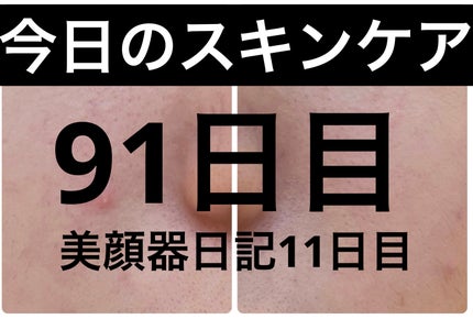 PDRN テンショントナーパッド/VT/トナーパッドを使ったクチコミ(1枚目)