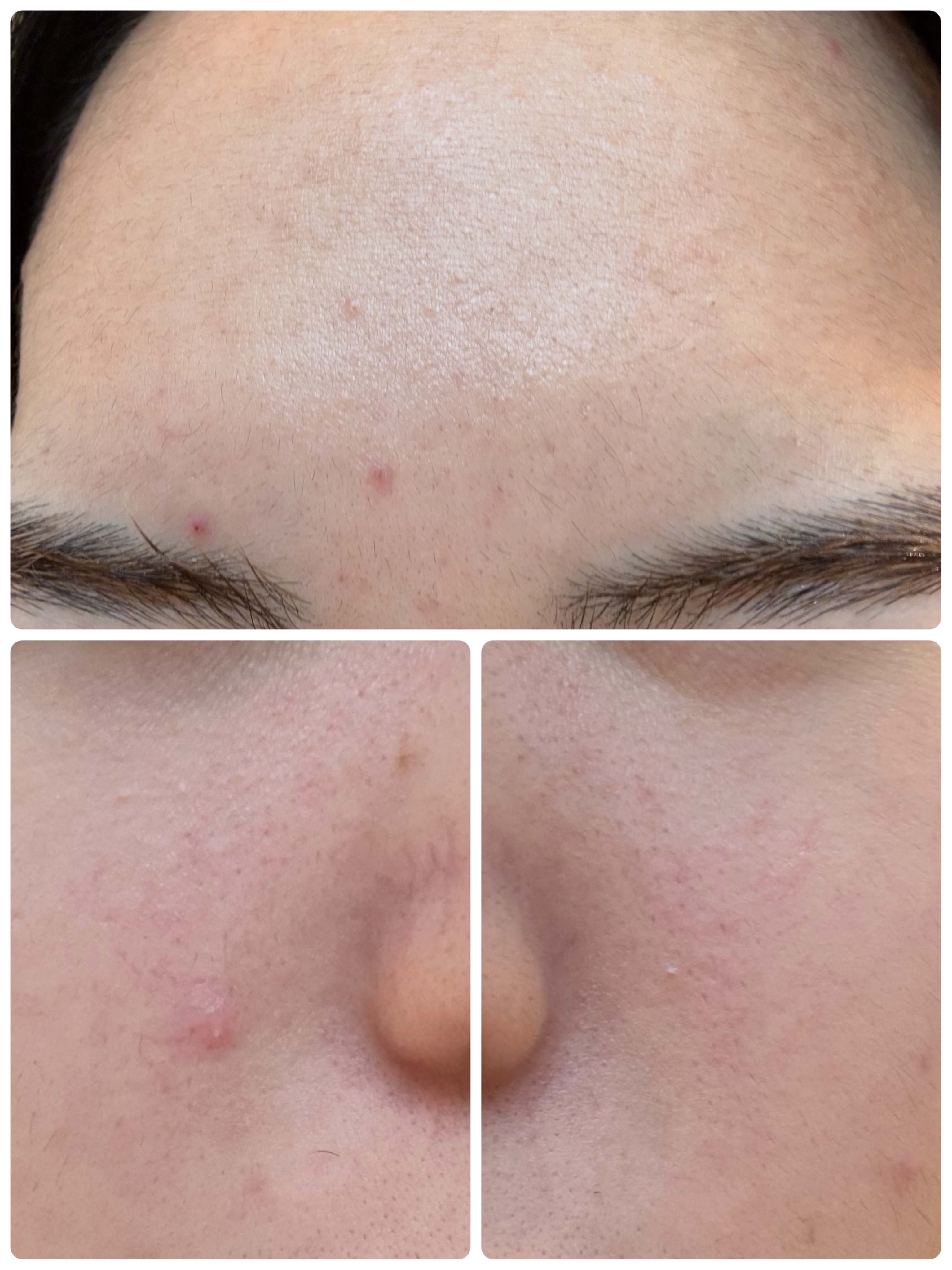 PDRN テンショントナーパッド/VT/トナーパッドを使ったクチコミ（3枚目）