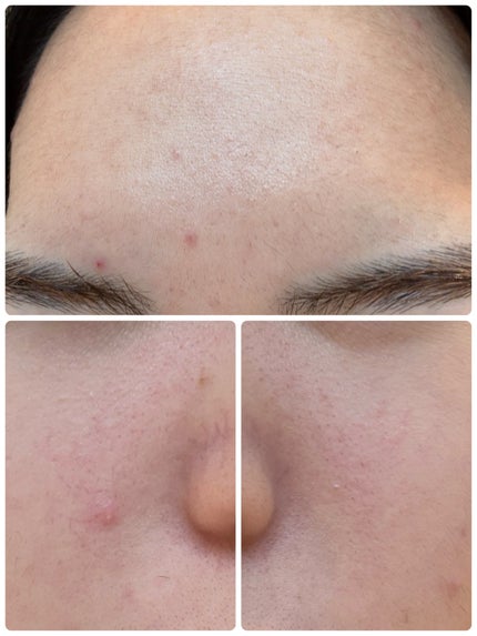 PDRN テンショントナーパッド/VT/トナーパッドを使ったクチコミ(3枚目)