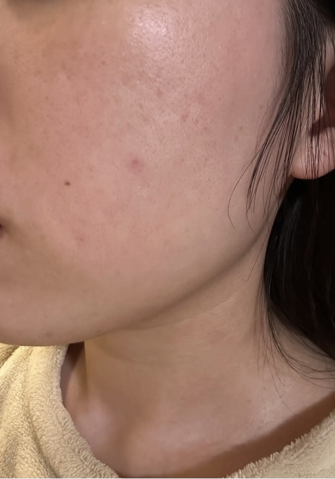 薬用CICAリペア クリーム/タイガレイド/フェイスクリームを使ったクチコミ（3枚目）