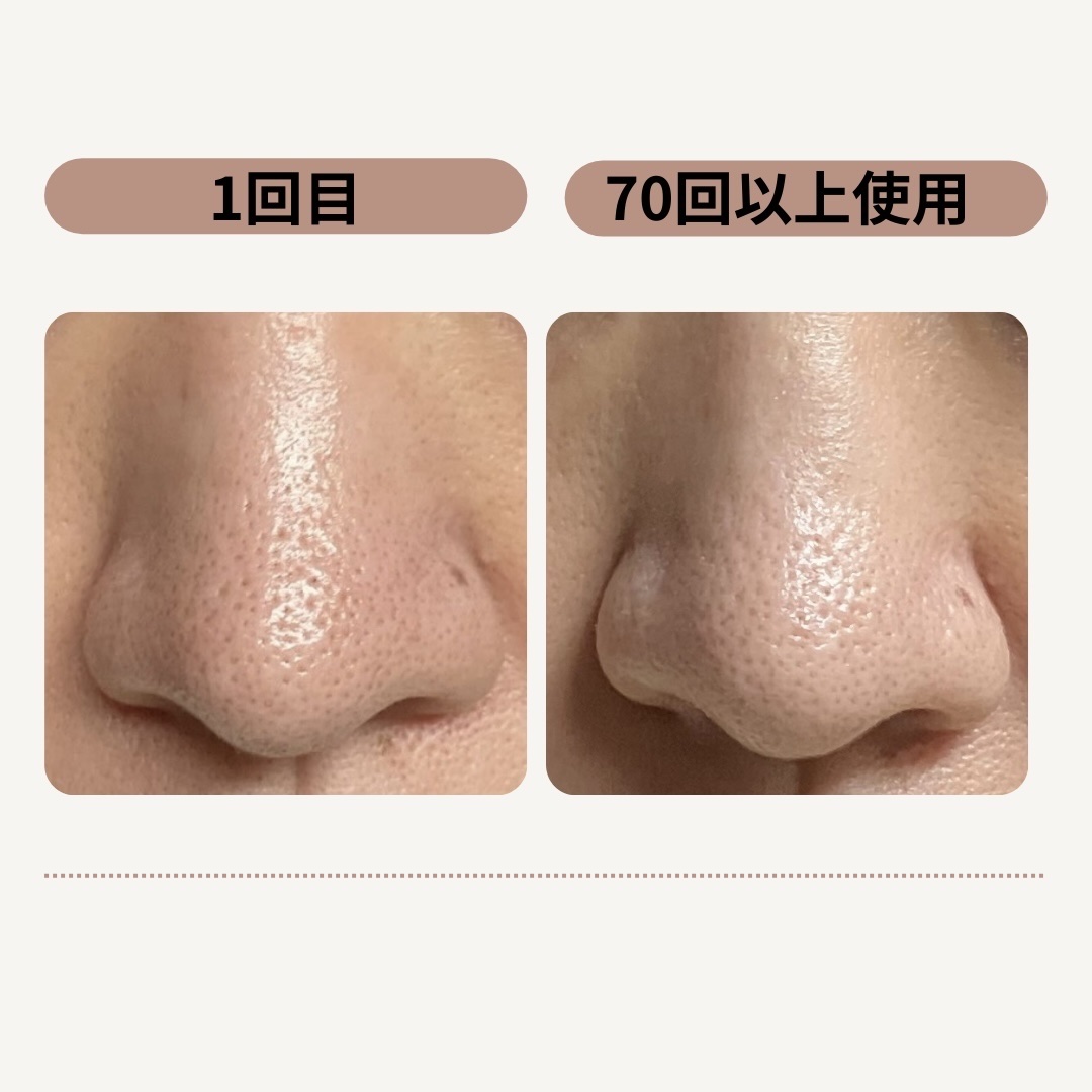 AQ 毛穴美容液オイル/DECORTÉ/フェイスオイルを使ったクチコミ（2枚目）