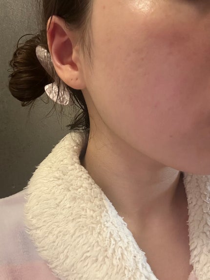 薬用CICAリペア クリーム/タイガレイド/フェイスクリームを使ったクチコミ(2枚目)