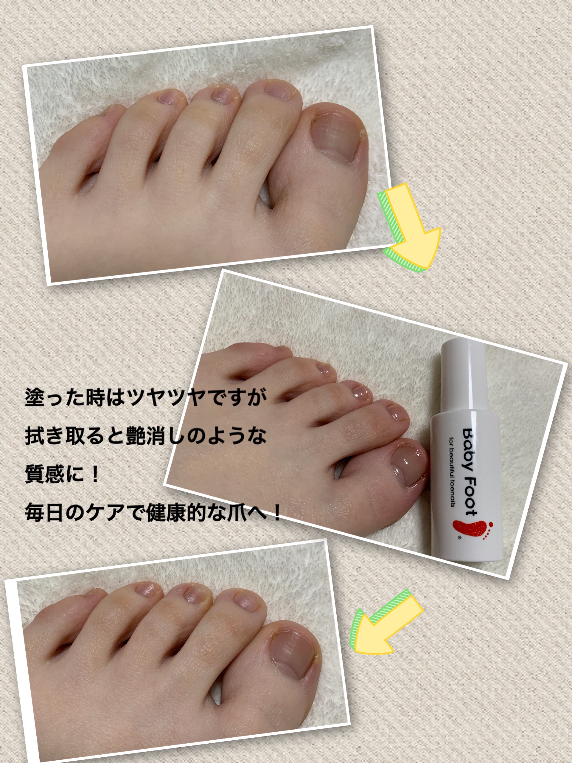 ベビーフット 足爪プロティンパック/ベビーフット/レッグ・フットケアを使ったクチコミ（3枚目）