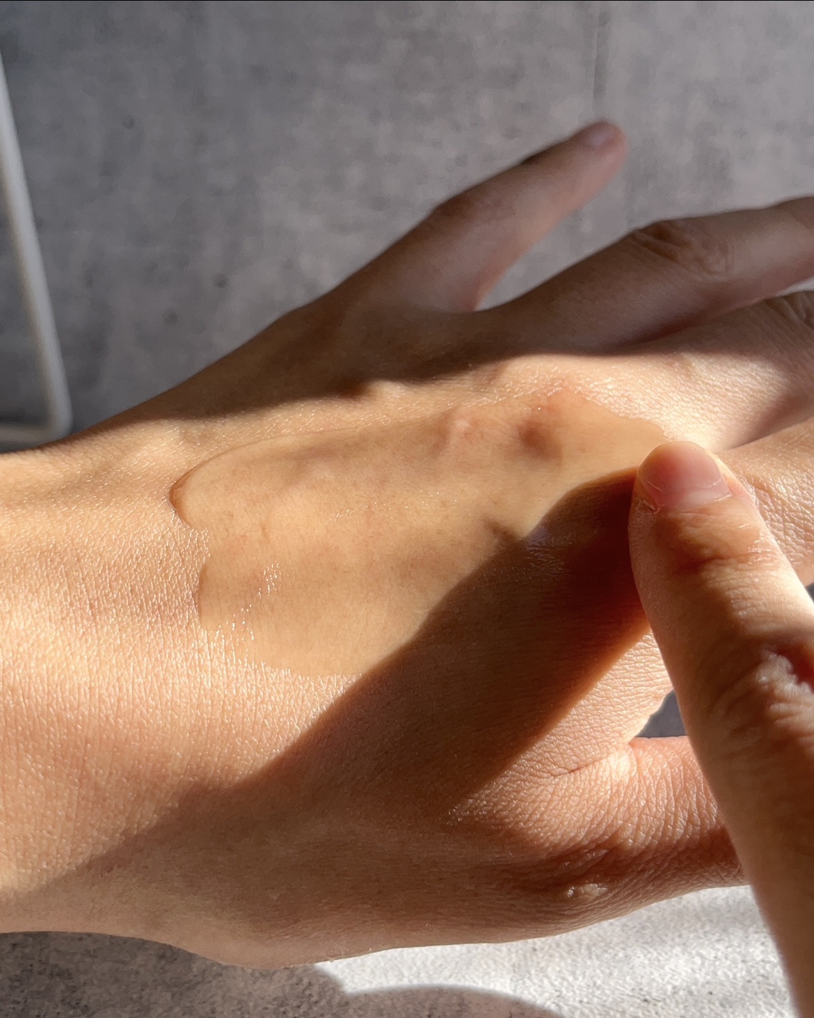 アネトス アクネケア トリートメント セラム/Anetos/美容液を使ったクチコミ（3枚目）