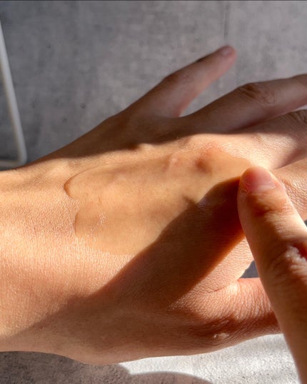 アネトス アクネケア トリートメント セラム/Anetos/美容液を使ったクチコミ(3枚目)