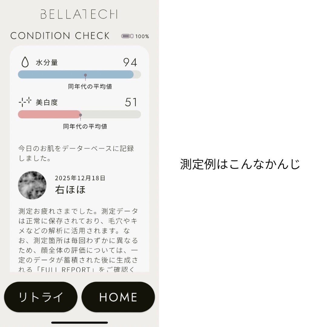スキンスキャナー/BELLATECH/その他スキンケアグッズを使ったクチコミ(7枚目)