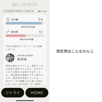 スキンスキャナー/BELLATECH/その他スキンケアグッズを使ったクチコミ(7枚目)