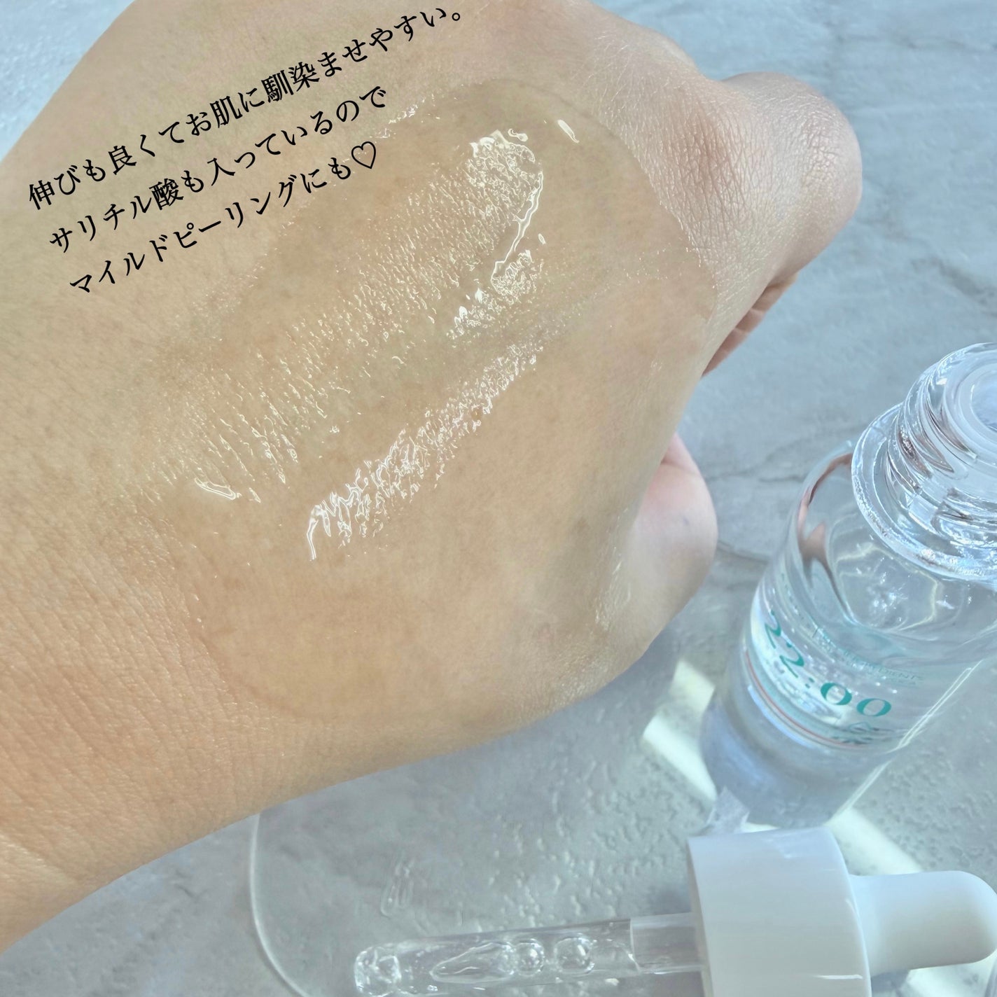 アネトス アクネケア トリートメント セラム/Anetos/美容液を使ったクチコミ(4枚目)