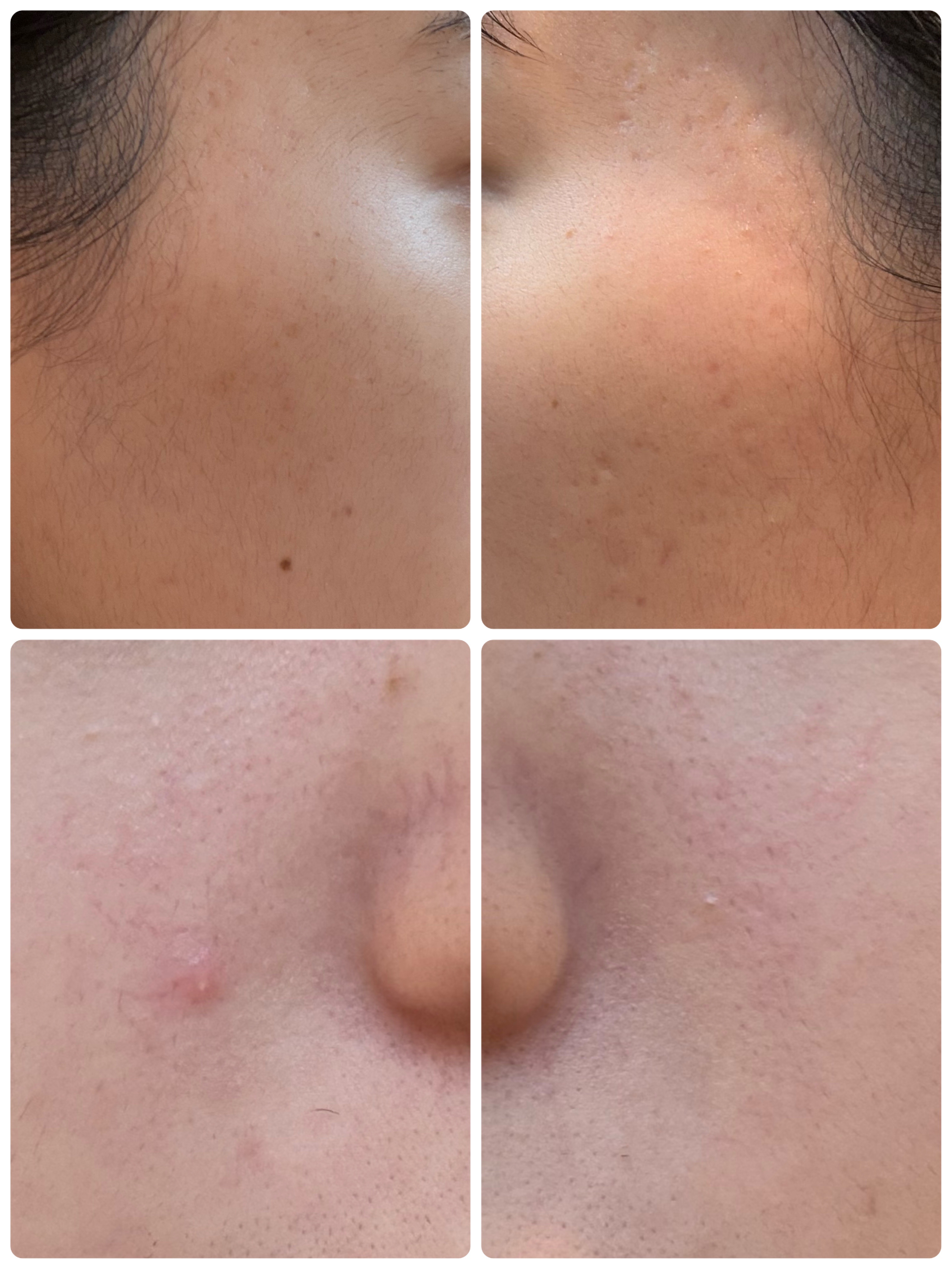 PDRN テンショントナーパッド/VT/トナーパッドを使ったクチコミ（2枚目）