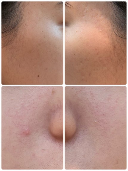 PDRN テンショントナーパッド/VT/トナーパッドを使ったクチコミ(2枚目)