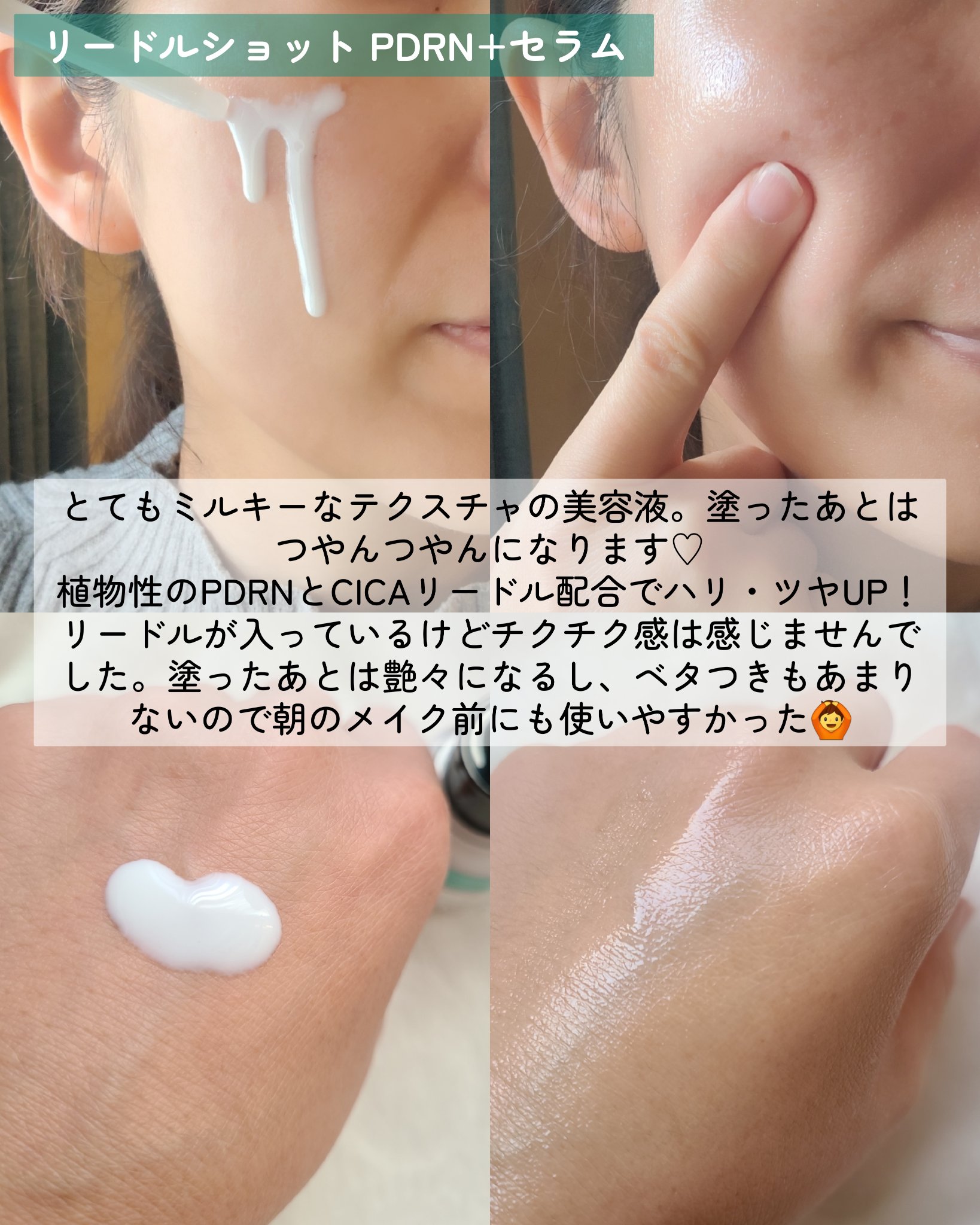 PDRN リードルショットアイリフター/VT/アイケア・アイクリームを使ったクチコミ（2枚目）