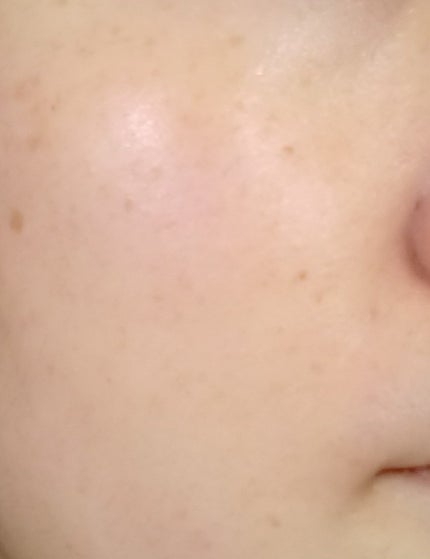 白潤薬用美白化粧水/肌ラボ/化粧水を使ったクチコミ(2枚目)