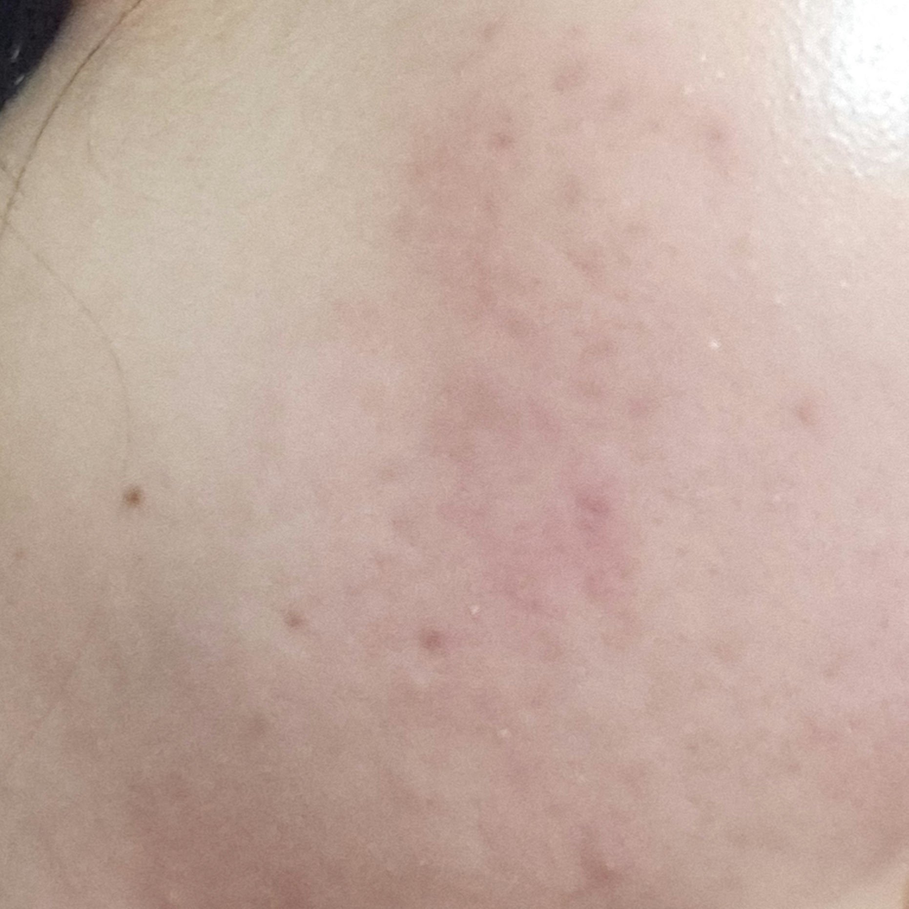 イハダ 薬用クリアエマルジョン/IHADA/乳液を使ったクチコミ（1枚目）