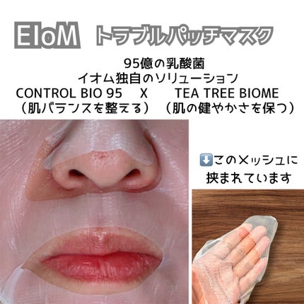 トラブルパッチマスク/EIOM/その他スキンケアを使ったクチコミ(3枚目)