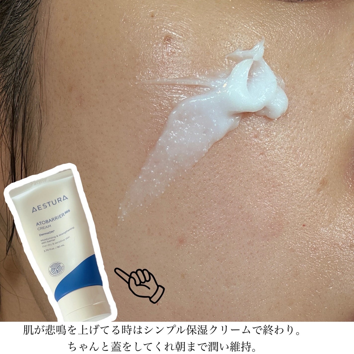 モイスチャー リッチローション(とてもしっとり)/アルージェ/化粧水を使ったクチコミ(4枚目)