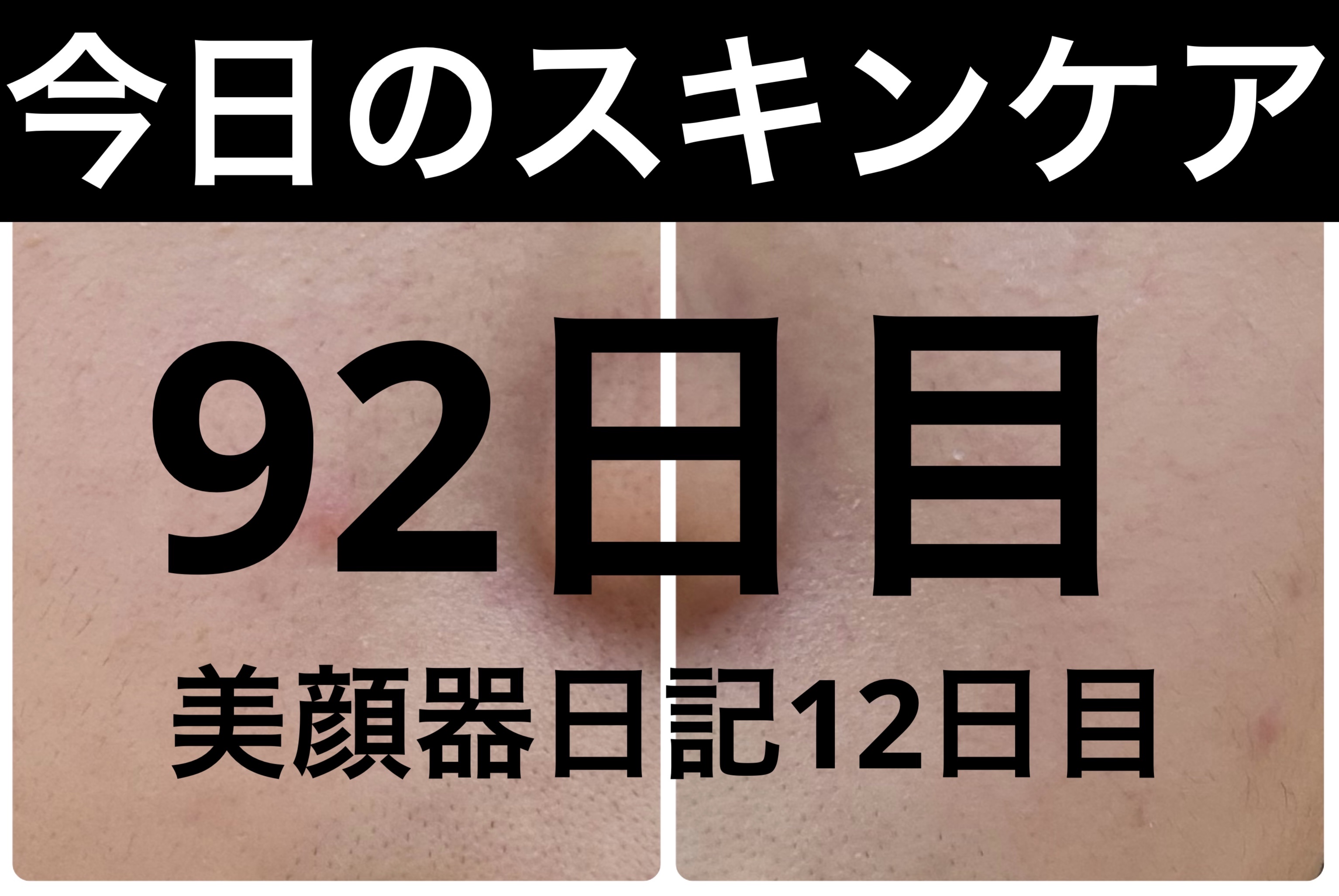 PDRN テンショントナーパッド/VT/トナーパッドを使ったクチコミ（1枚目）