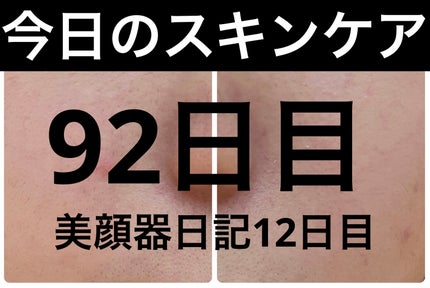 PDRN テンショントナーパッド/VT/トナーパッドを使ったクチコミ(1枚目)