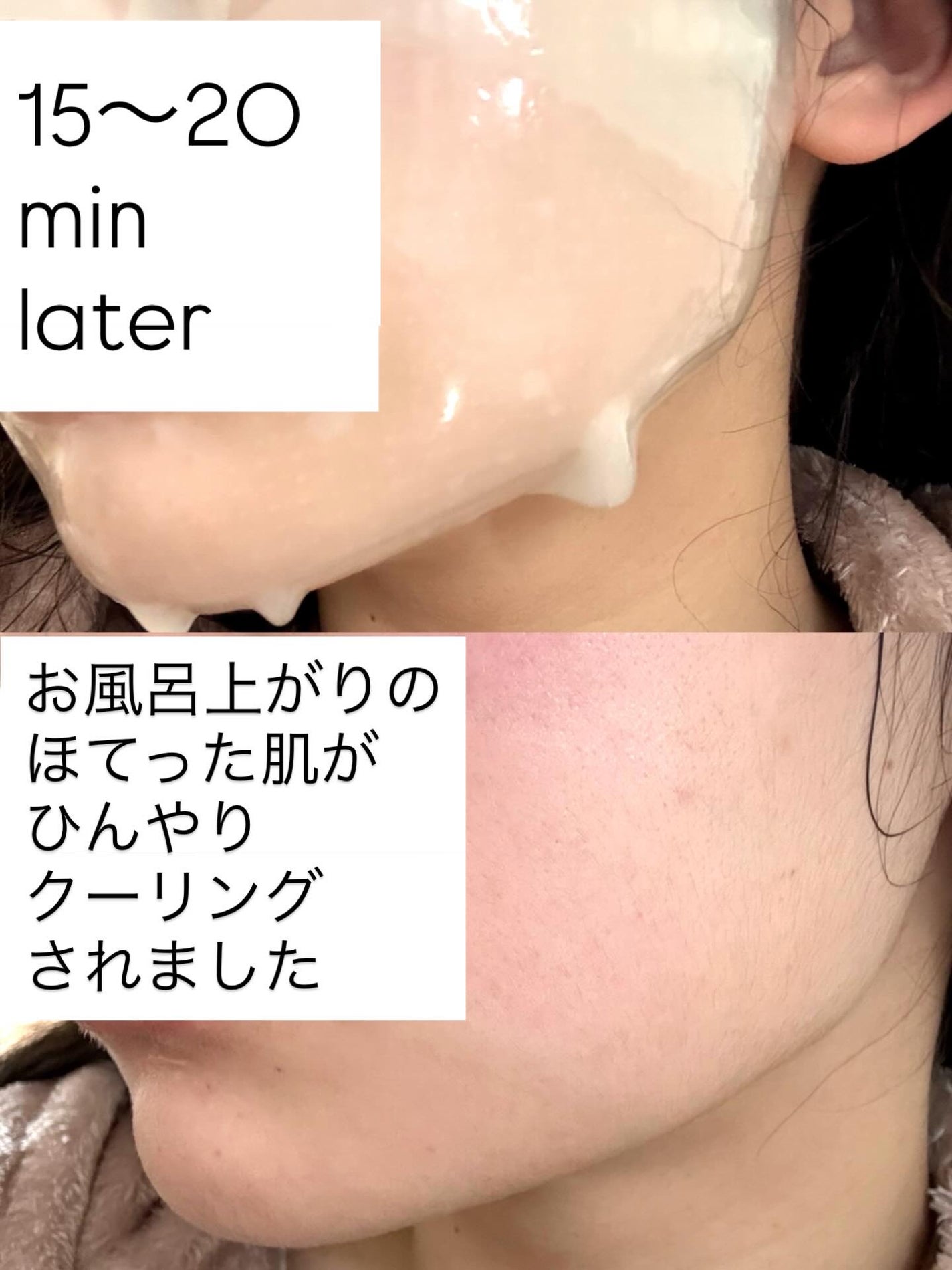 super power mask/AROCELL/シートマスク・パックを使ったクチコミ(10枚目)